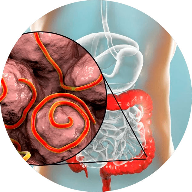 Seedetrakt ja parasiidid