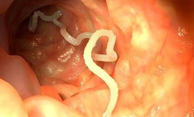 parasiitide põhjused inimkehas