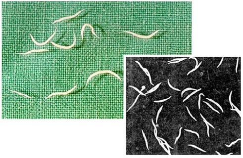 pinworms inimkehast